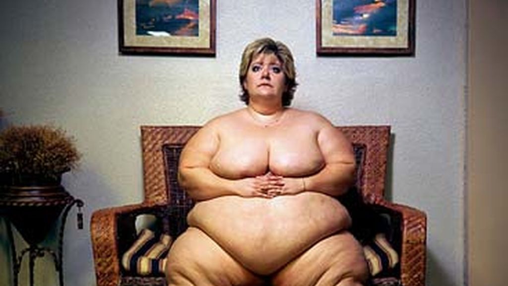 La belleza de la obesidad