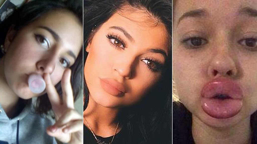 #kyliejennerchallenge: ¿Pasos para tener los labios de Kylie Jenner?