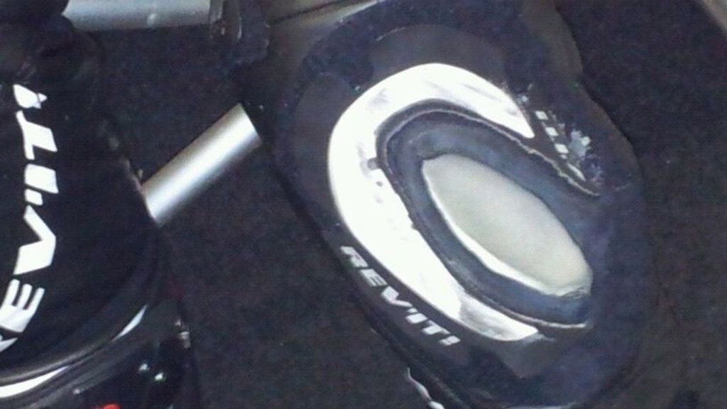 La rodilla de Bautista