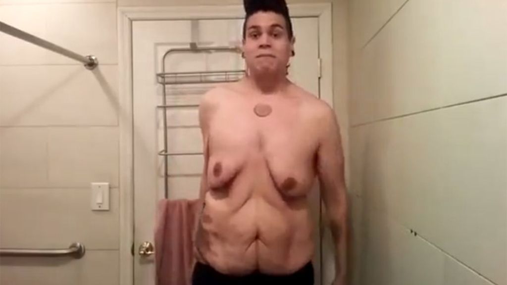 Un joven muestra su cuerpo tras perder 120 kilos para mandar un mensaje positivo
