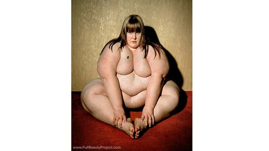 La belleza de la obesidad