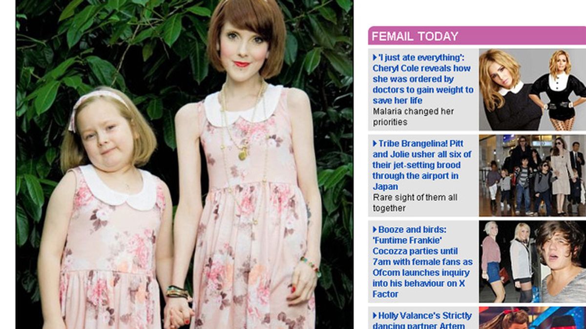 Madre e hija usando la misma ropa. La mujer de 26 años sufre anorexia desde los 13 años.