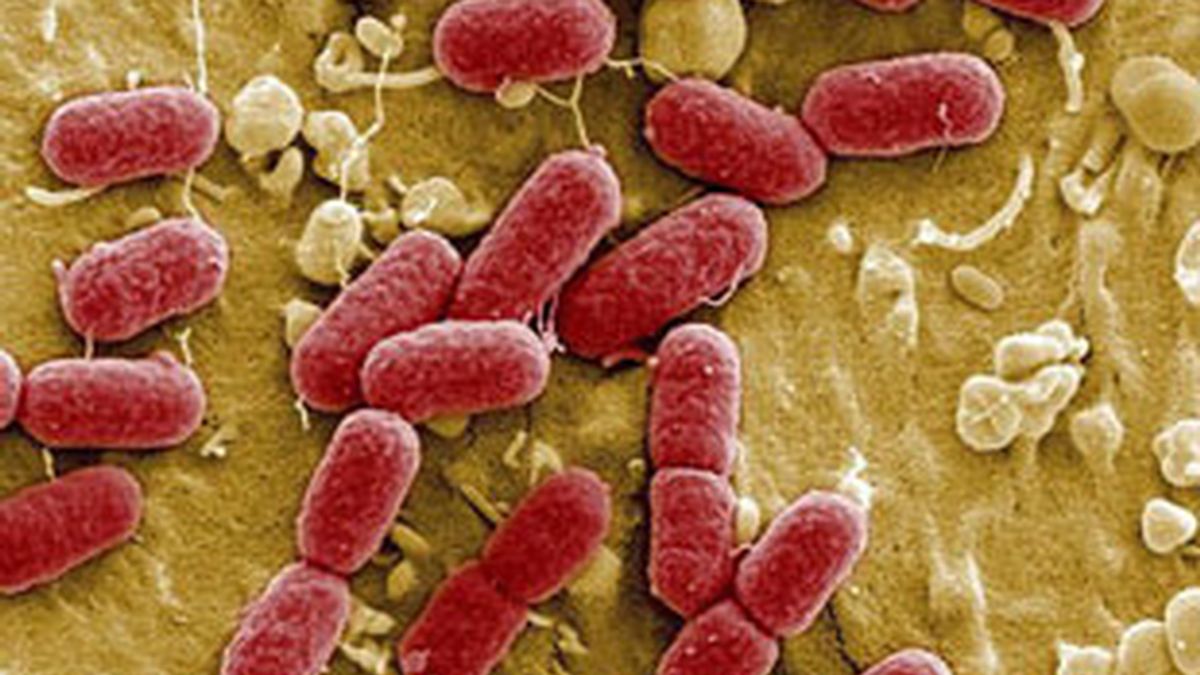 La bacteria Escherichia Coli, E. coli. Vídeo: Informativos Telecinco.