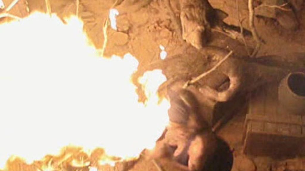 Sonia se quema la cara