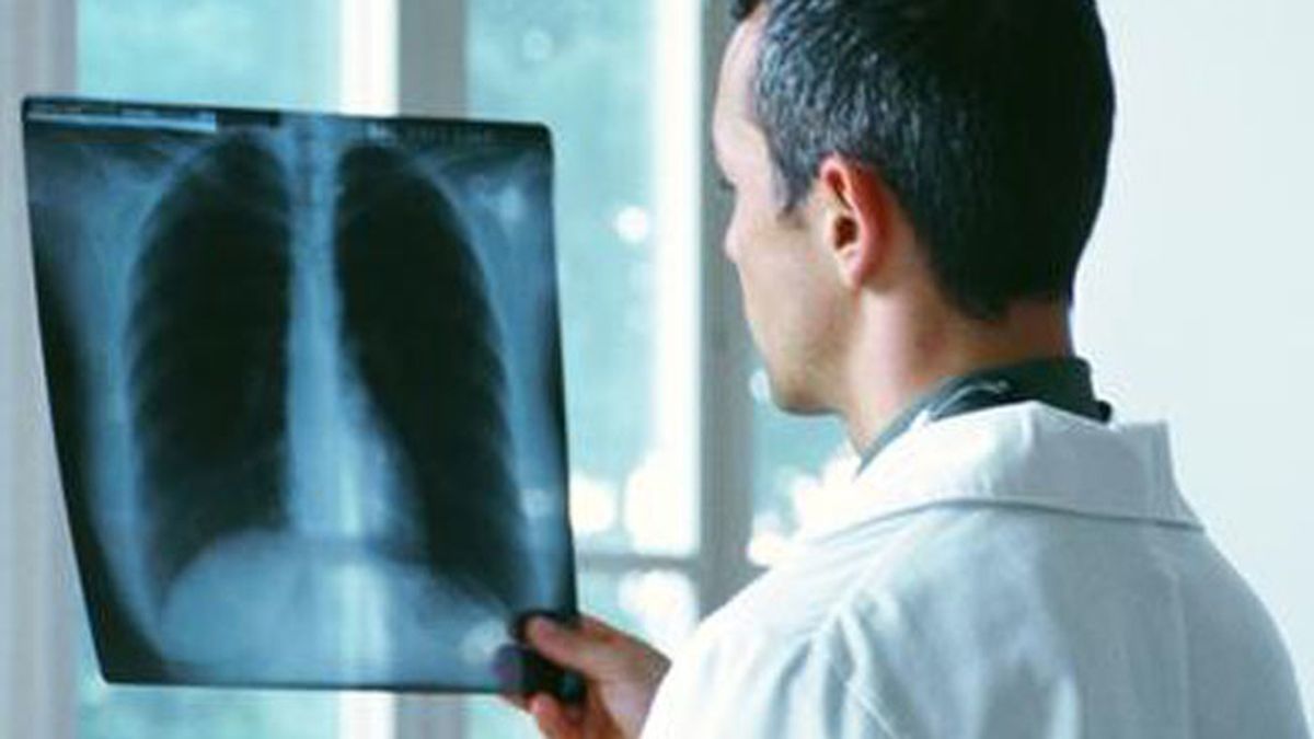 Detectan el cáncer de pulmón por el aliento