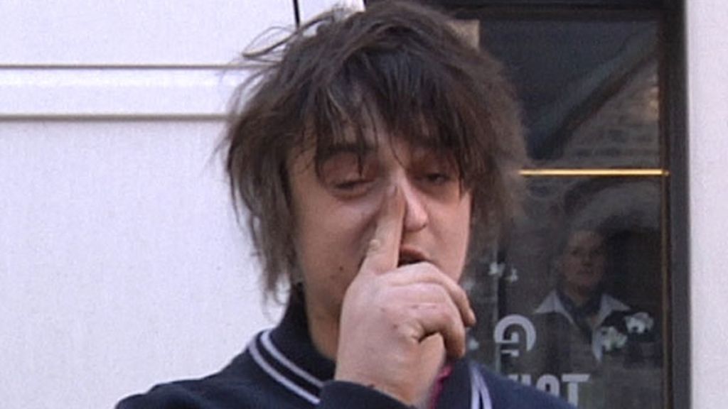 Pete Doherty, con mocos, pelos y a lo loco