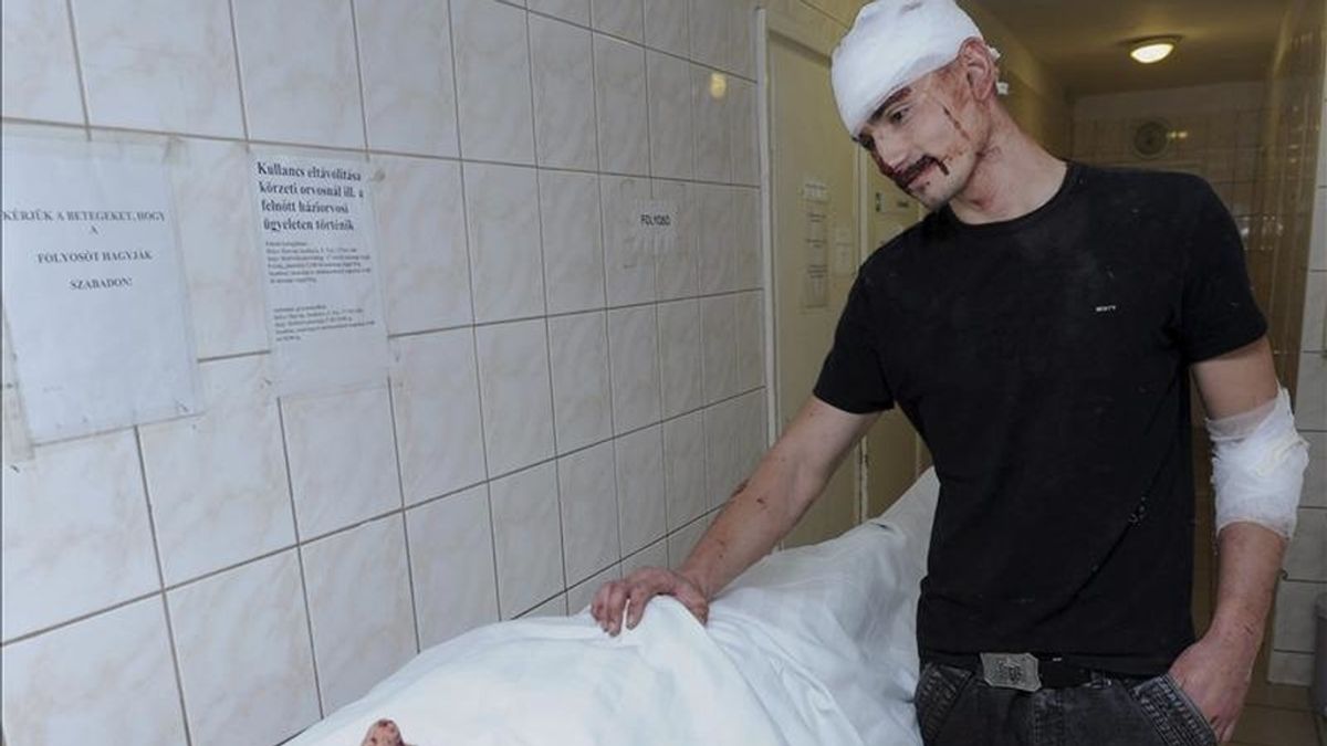Un gitano romaní herido conforta a otro que permanece en peor estado en el hospital de Hatvan, a unos 57 kilómetros al este de Budapest, Hungría, a primera hora de hoy, miércoles 27 de abril de 2011. EFE
