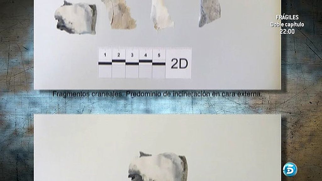 Imágenes de los huesos óseos encontrados en la finca de José Bretón