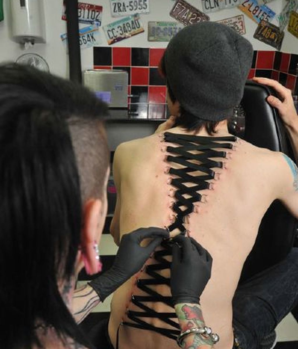 Corsés anclados en la piel