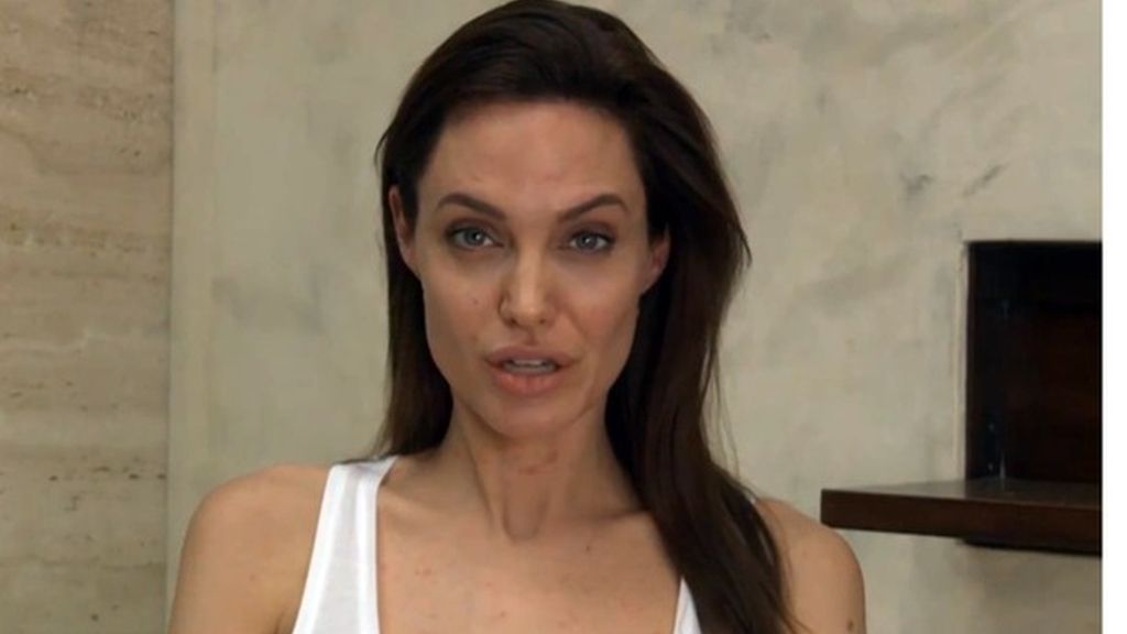 Angelina Jolie nos cuenta que tiene varicela