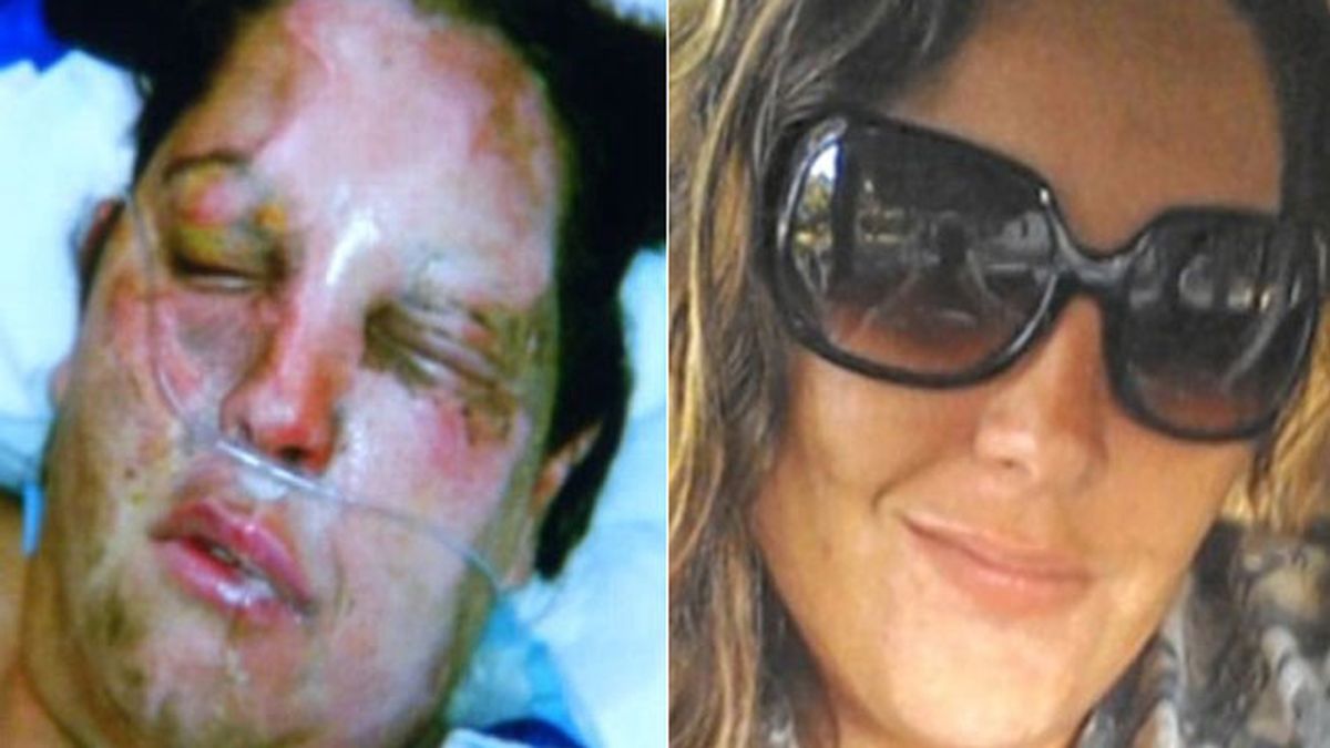 Arde la cara de una paciente en un hospital de Florida