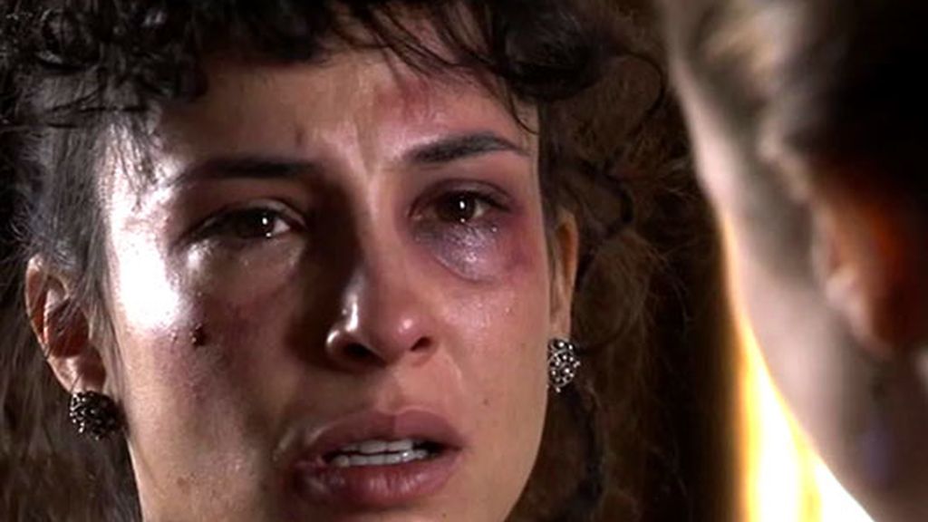 Falcón le pone a Victoria un ojo morado Falcón le pone a Victoria un ojo morado