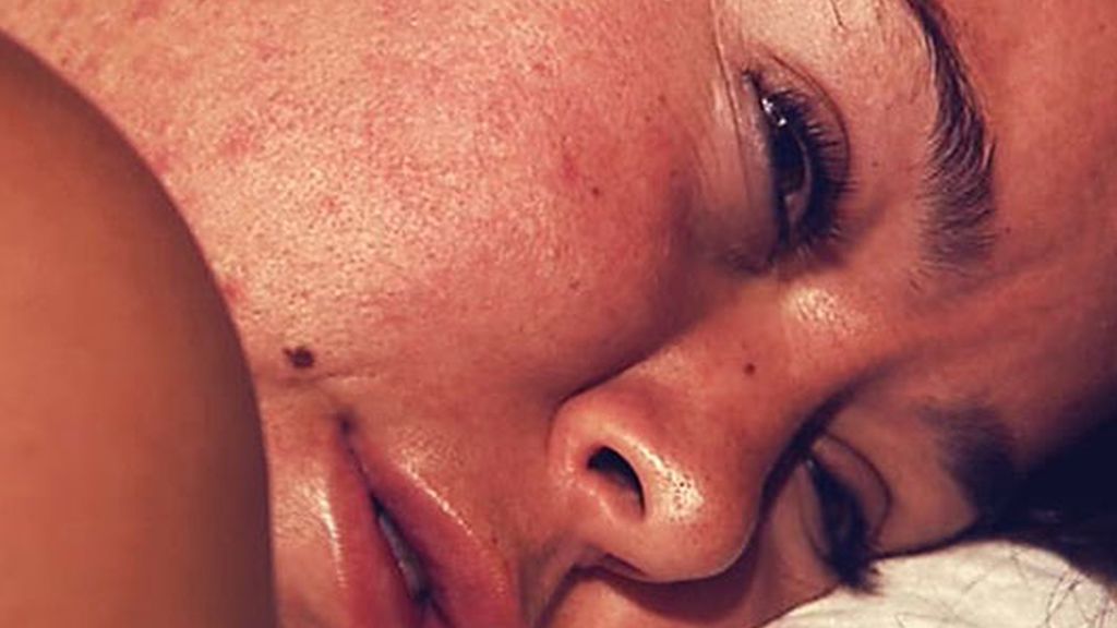 Chiqui se relaja con cosquillas