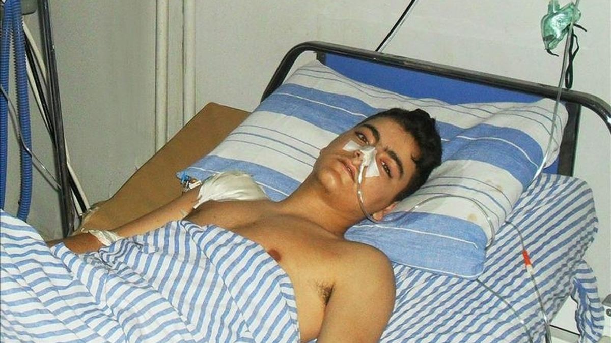 Fotografía cedida hoy de uno de los heridos en un tiroteo llevado a cabo por desconocidos en la ciudad de Latakia, al norte de Siria, según la agencia oficial siria SANA. EFE/SANA