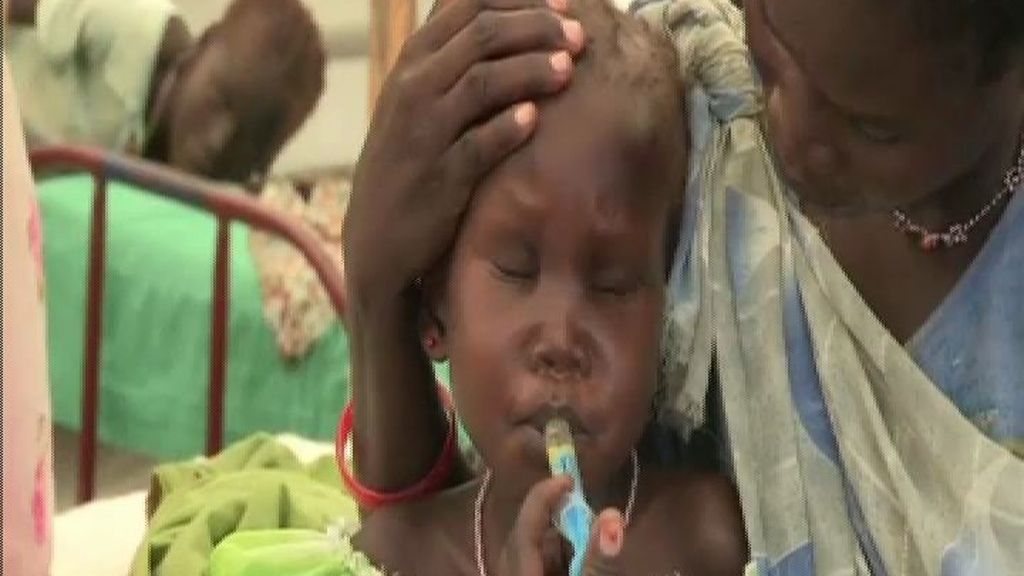 Alarma por la desnutrición de los niños en Sudán del Sur