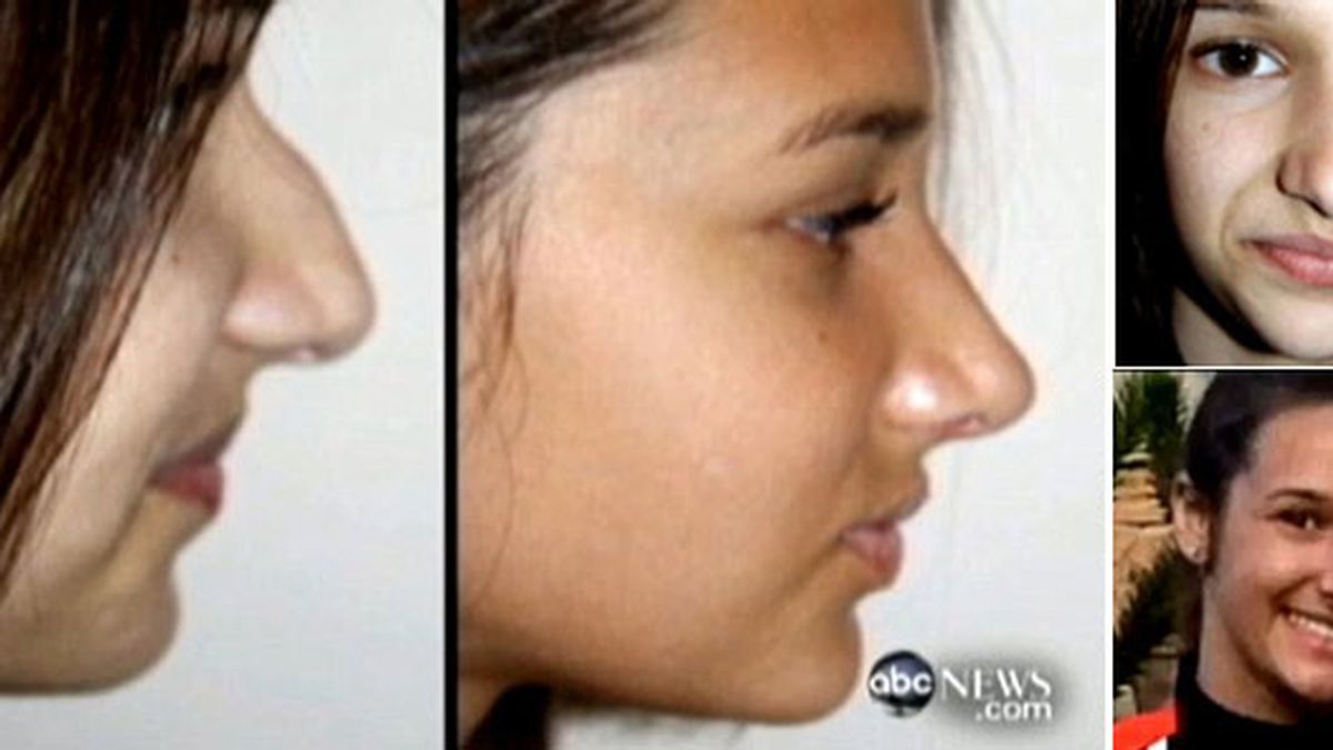 El antes y el después de Nicolette en imágenes difundidas por la cadena ABC.News.