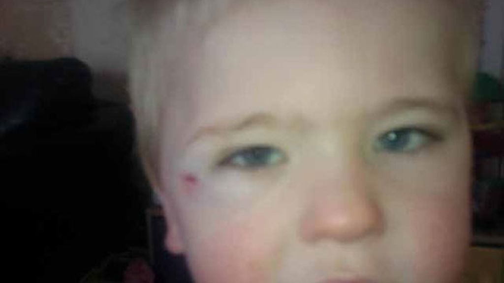 El niño que no siente dolor