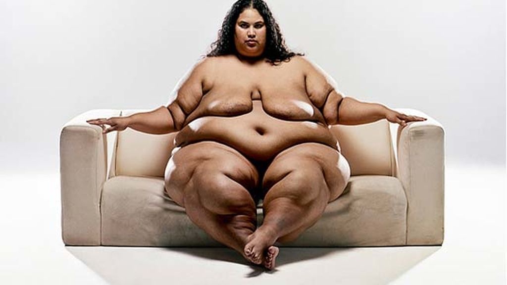 La belleza de la obesidad