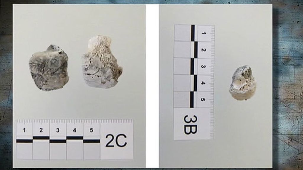 El informe Etxeberría revela restos humanos en las Quemadillas
