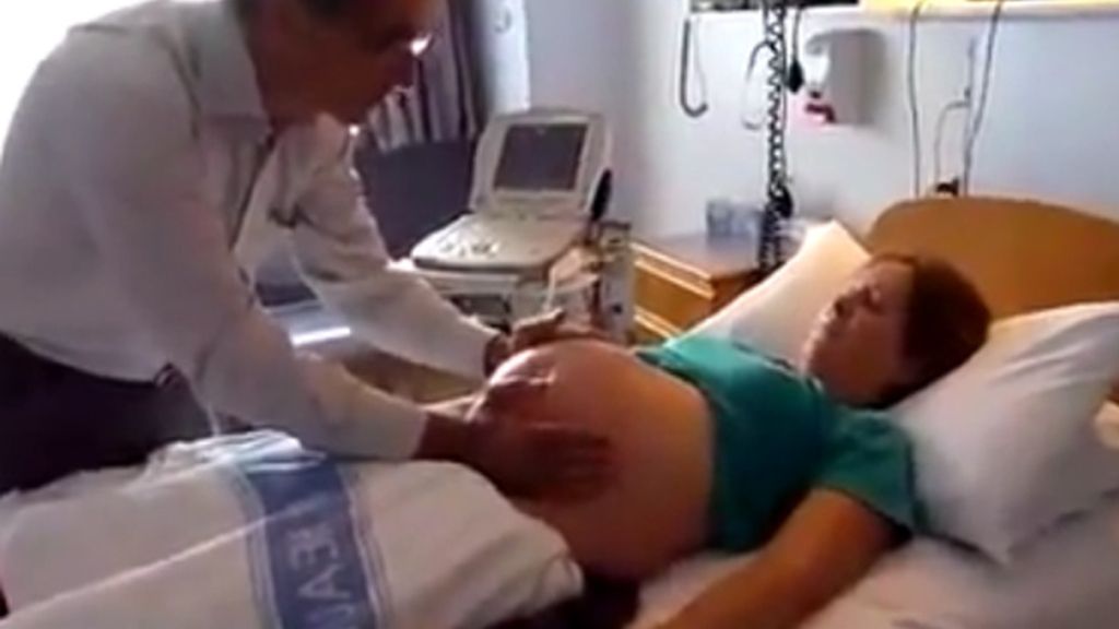 Un médico da la vuelta con sus manos a un bebé de nalgas en el vientre de su madre