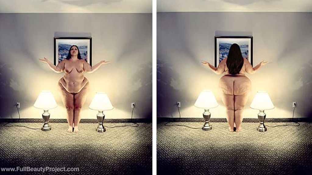 La belleza de la obesidad
