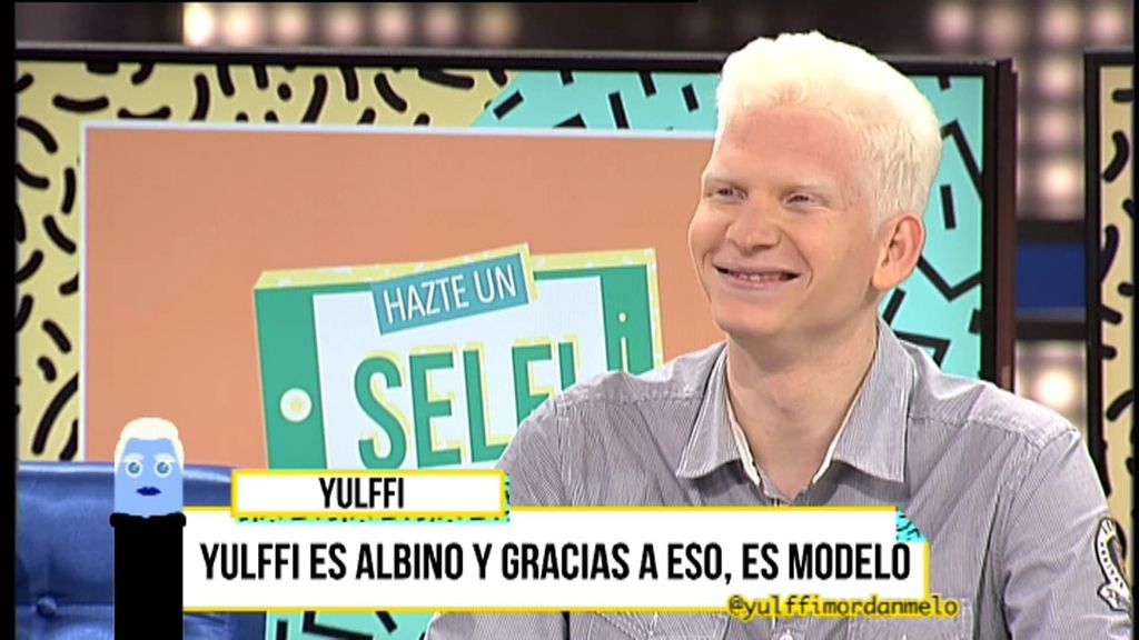 Yulffi, el primer modelo español albino