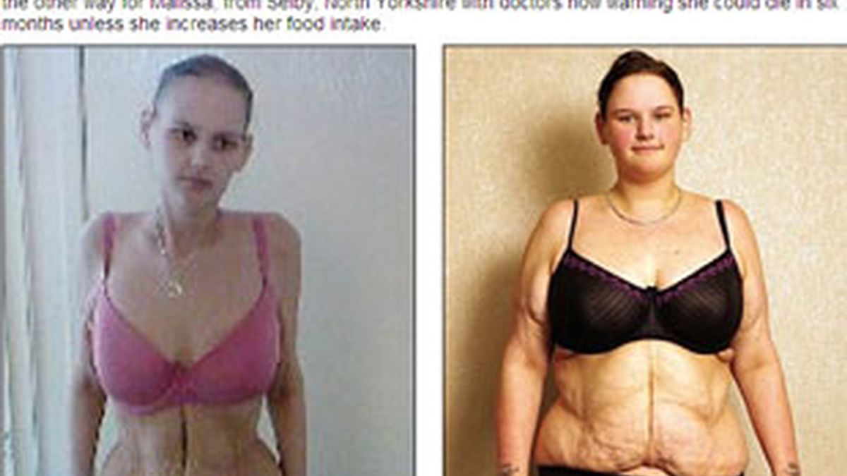 La adolescente más gorda de Reino Unido ahora sólo pesa 51 kilos. Foto: Daily Mail.