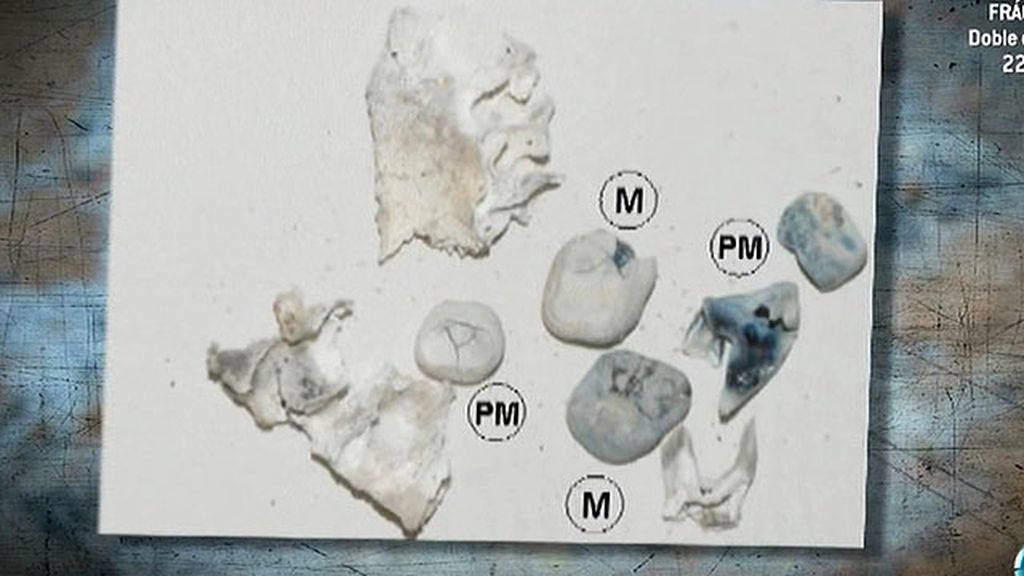 El informe Etxeberría revela restos humanos en las Quemadillas
