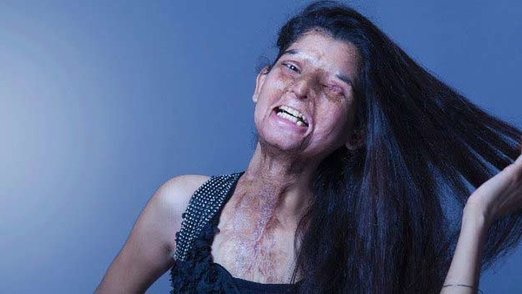 Cinco mujeres indias agredidas con ácido se ponen el mundo por montera