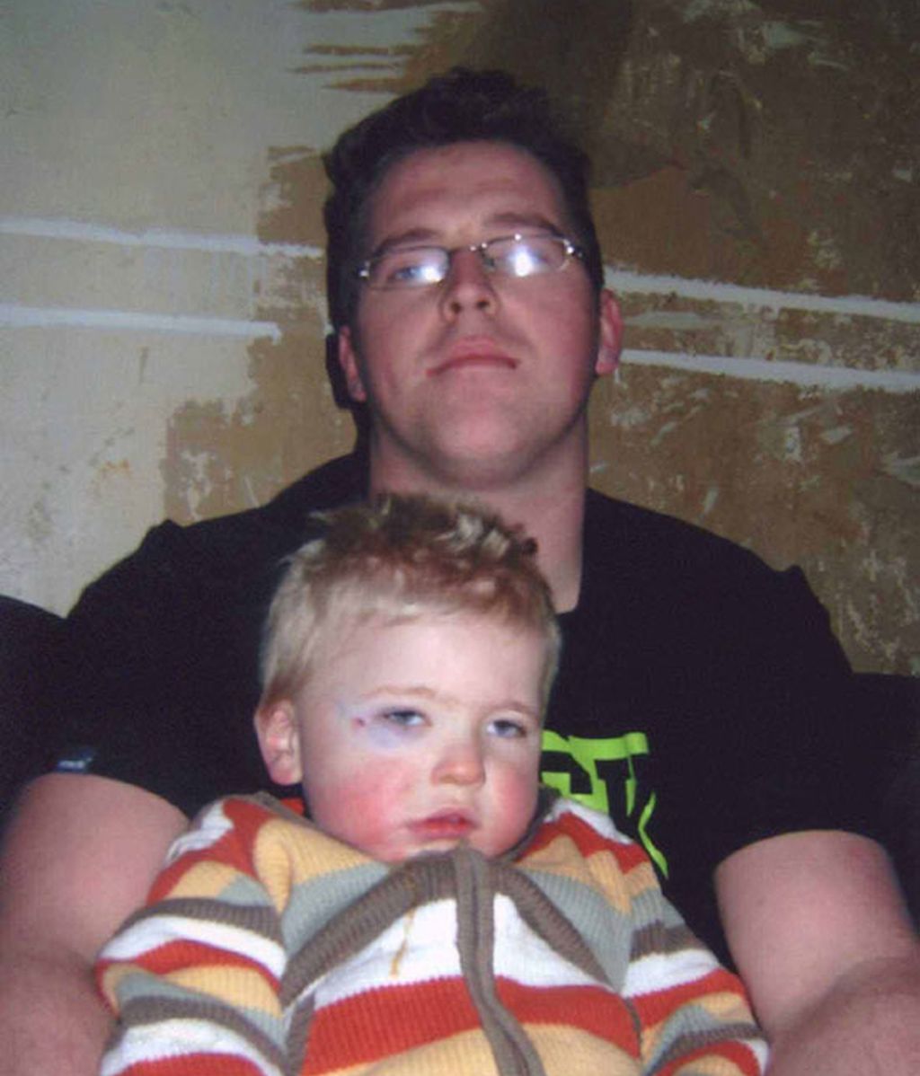 El niño que no siente dolor