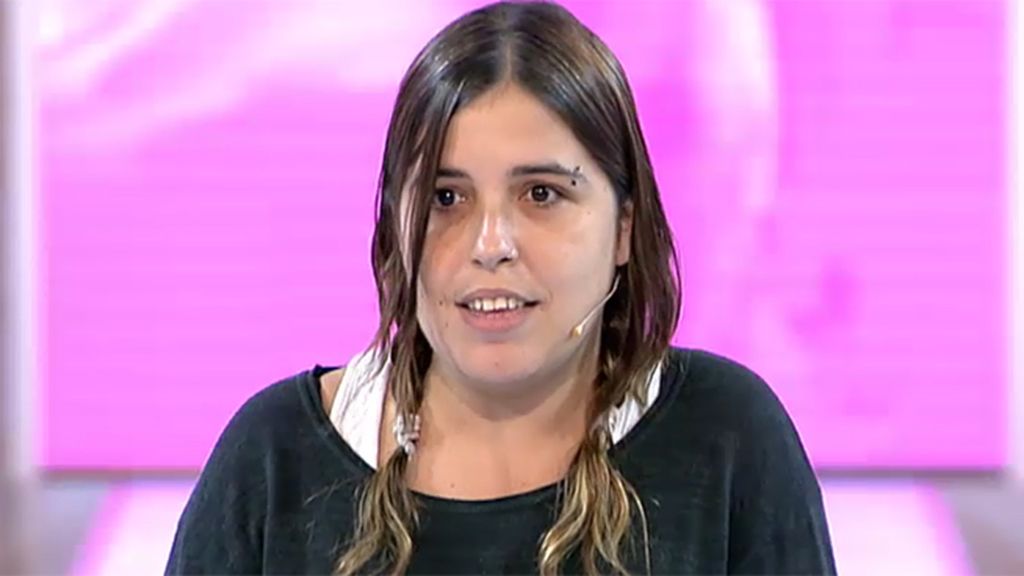 Rocío no puede vestir normal por una enfermedad degenerativa