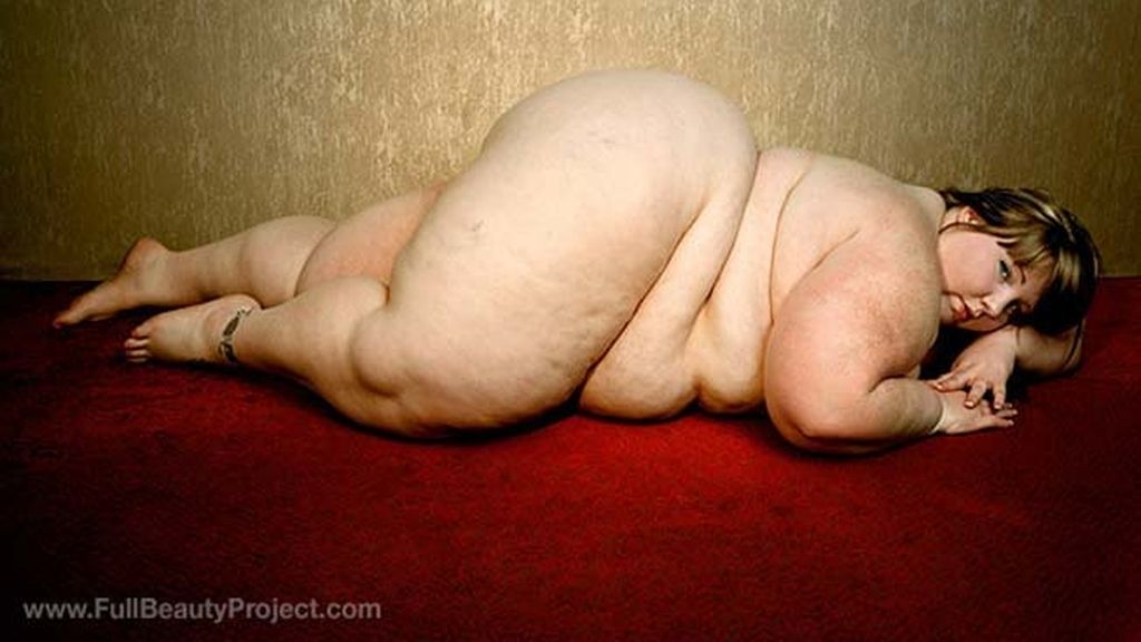 La belleza de la obesidad