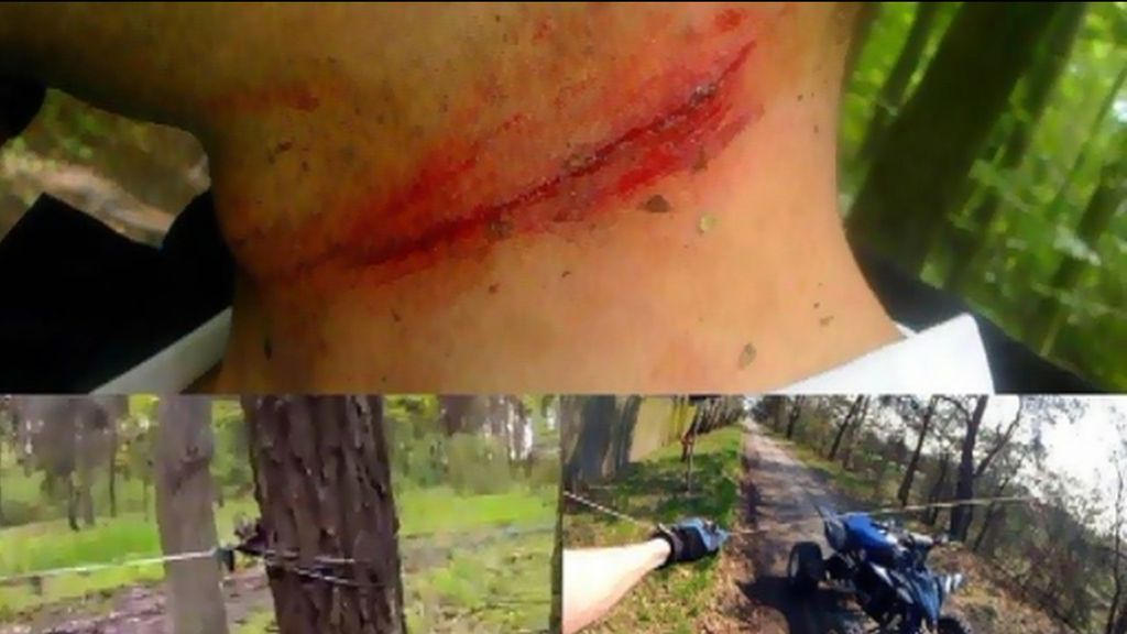 Un ciclista pierde la vida al toparse con un cable en su camino