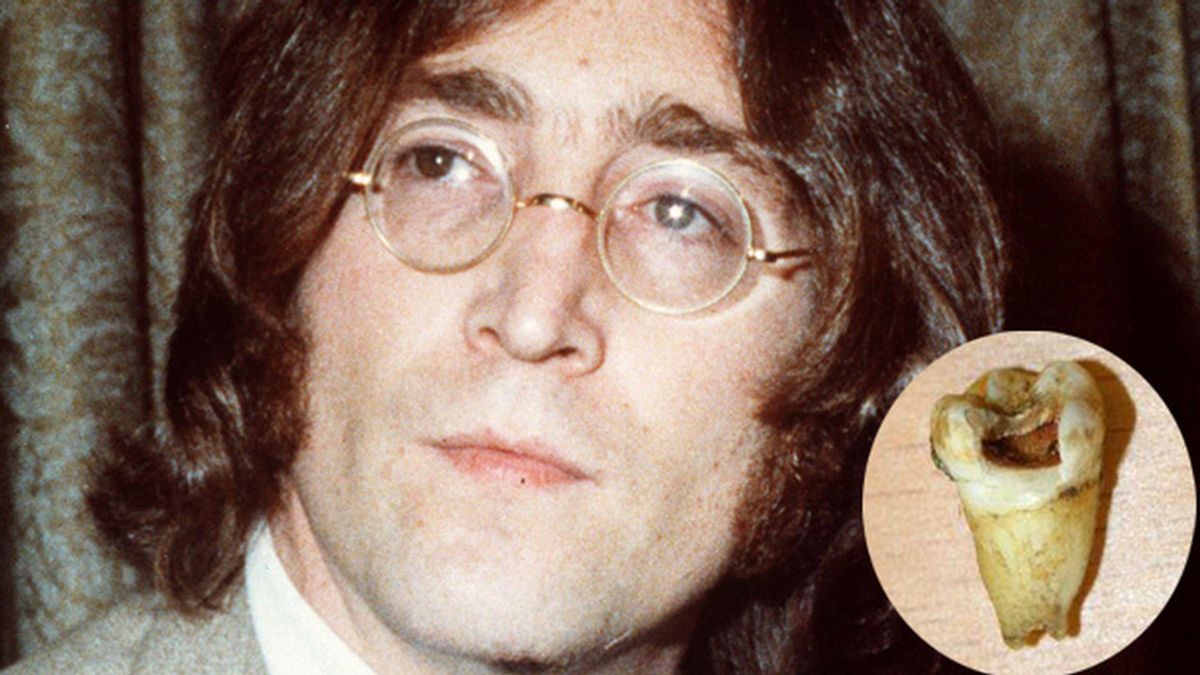 Subastan un diente cariado de John Lennon por 22..000 euros