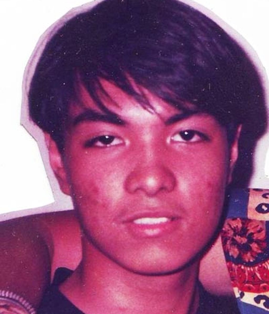 Herbert Chavez antes de la operación