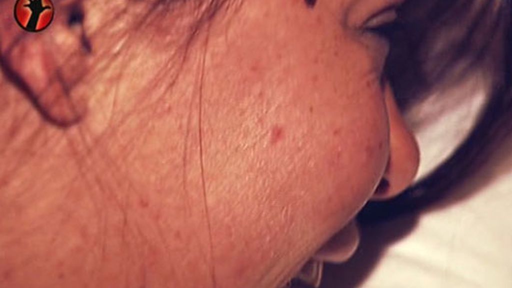 Chiqui se relaja con cosquillas