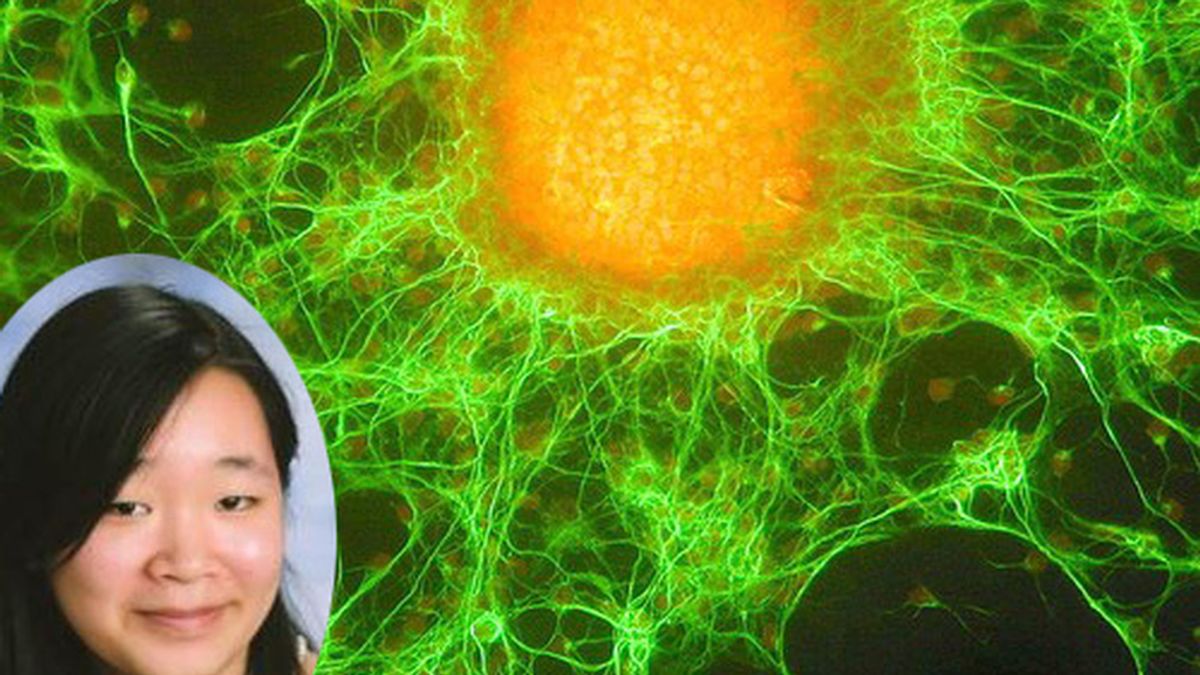 Célula cancerígena y Angela Zhang