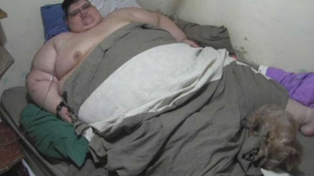 Juan Pedro o la lucha contra la obesidad del hombre más gordo del mundo