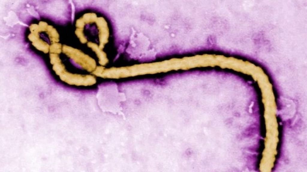 Preocupación por las secuelas que el virus del ébola dejará en los órganos de Teresa