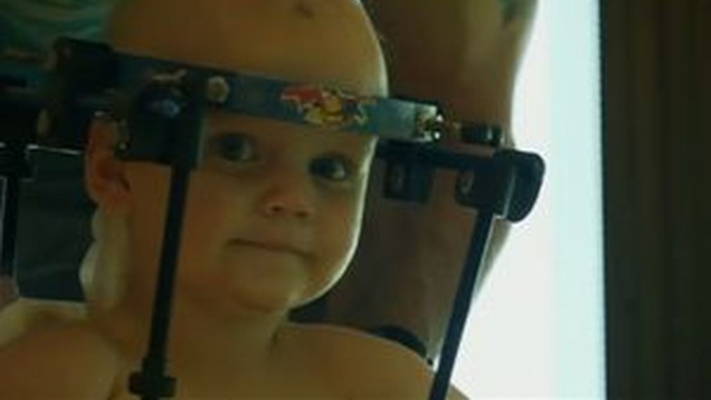 Unen el cráneo de un bebé a su cuello al sufrir un accidente de tráfico