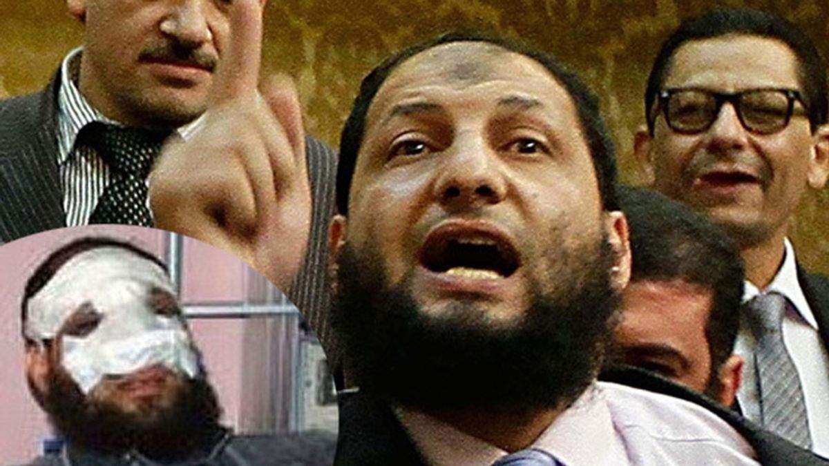 Político egipcio, cirugía estética, nariz