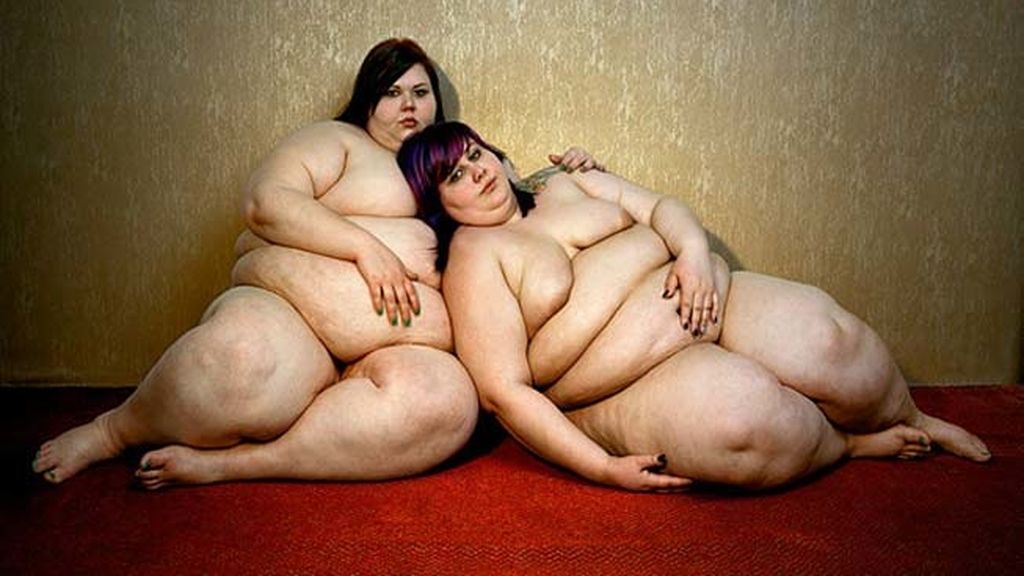 La belleza de la obesidad