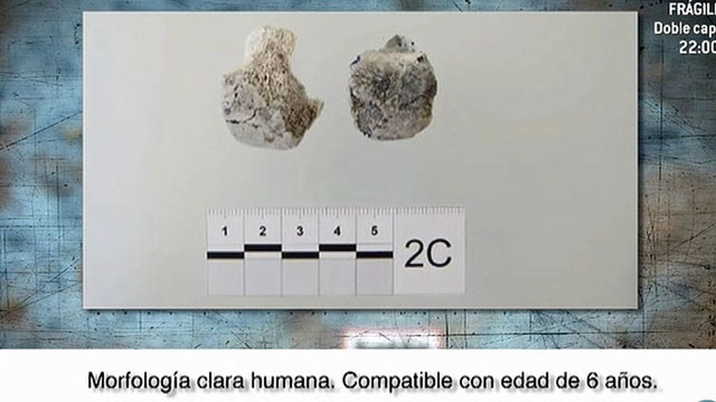 El informe Etxeberría revela restos humanos en las Quemadillas