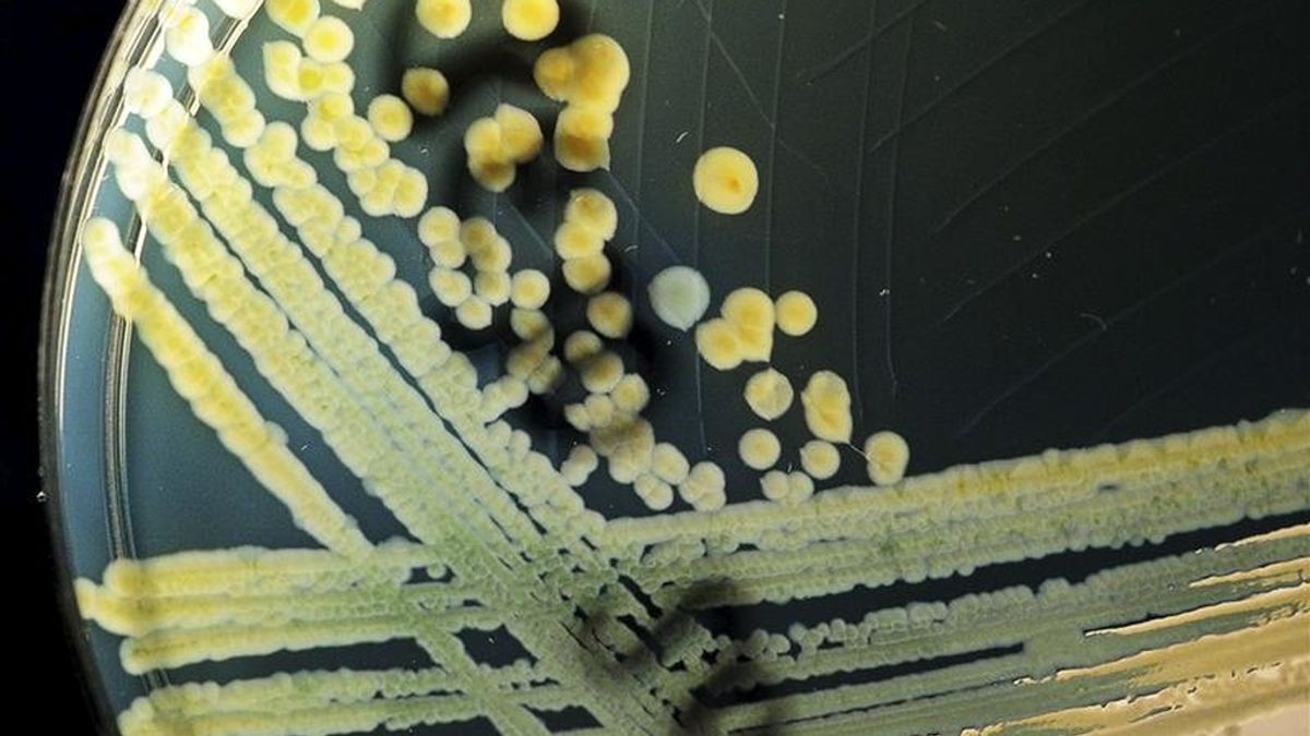 Una colonia de la bacteria Coli en un plato en el Consejo Estatal de Salud en Hanover, Alemania. Científicos están investigando los orígenes de la amenaza para la vida de la bacteria E. coli después de que numerosas personas se infectaron en Alemania. EFE