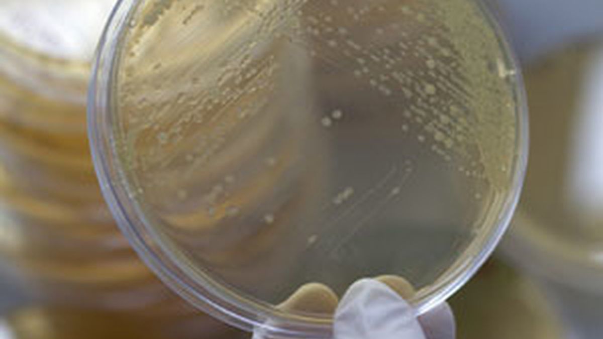 Un laboratorio estudia cepas de la bacteria E.Coli en las células de un vegetal. Foto: Reuters