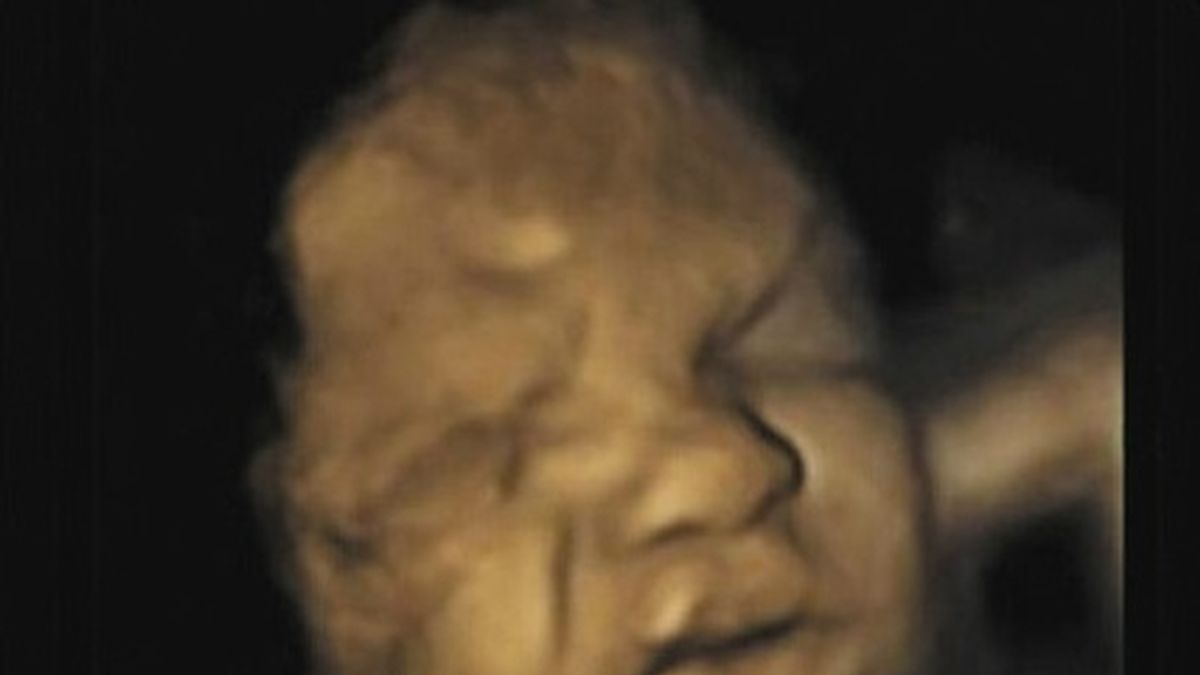 Los fetos aprenden a llorar en el útero
