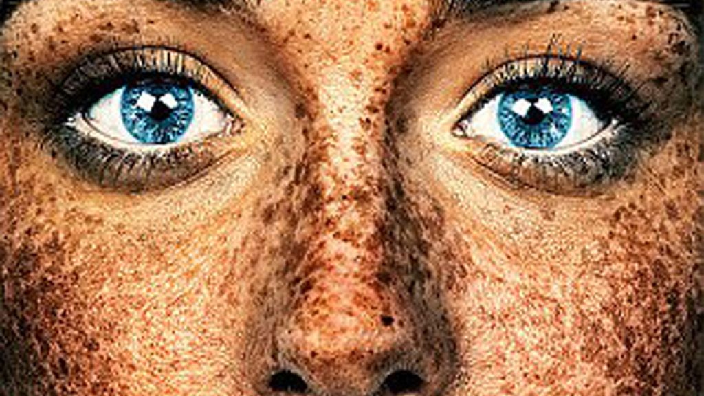 Las pecas son imperfecciones, la campaña publicitaria que indigna a los londinenses