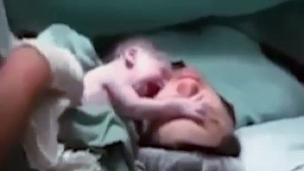 Un bebé recién nacido se niega a ser separado de su madre nada más nacer