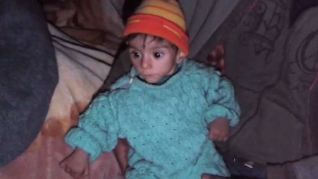 Madaya, el infierno sirio donde el hambre se ha convertido en arma de guerra