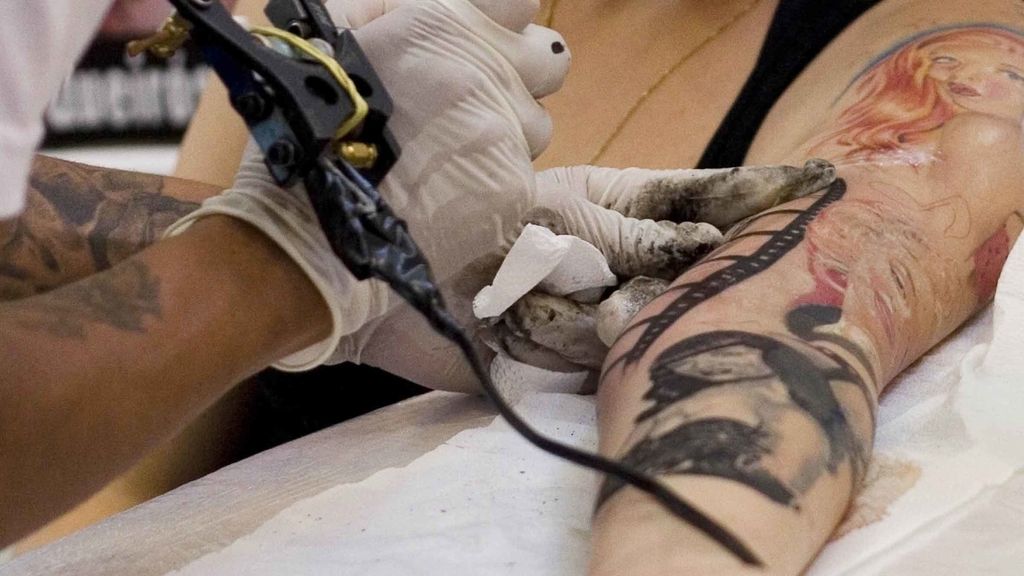 Nuevas técnicas para eliminar tatuajes